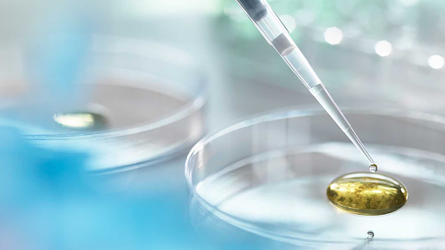 Thumbnail for Sheffield scientists receive £150,000 boost for pioneering dementia research | …