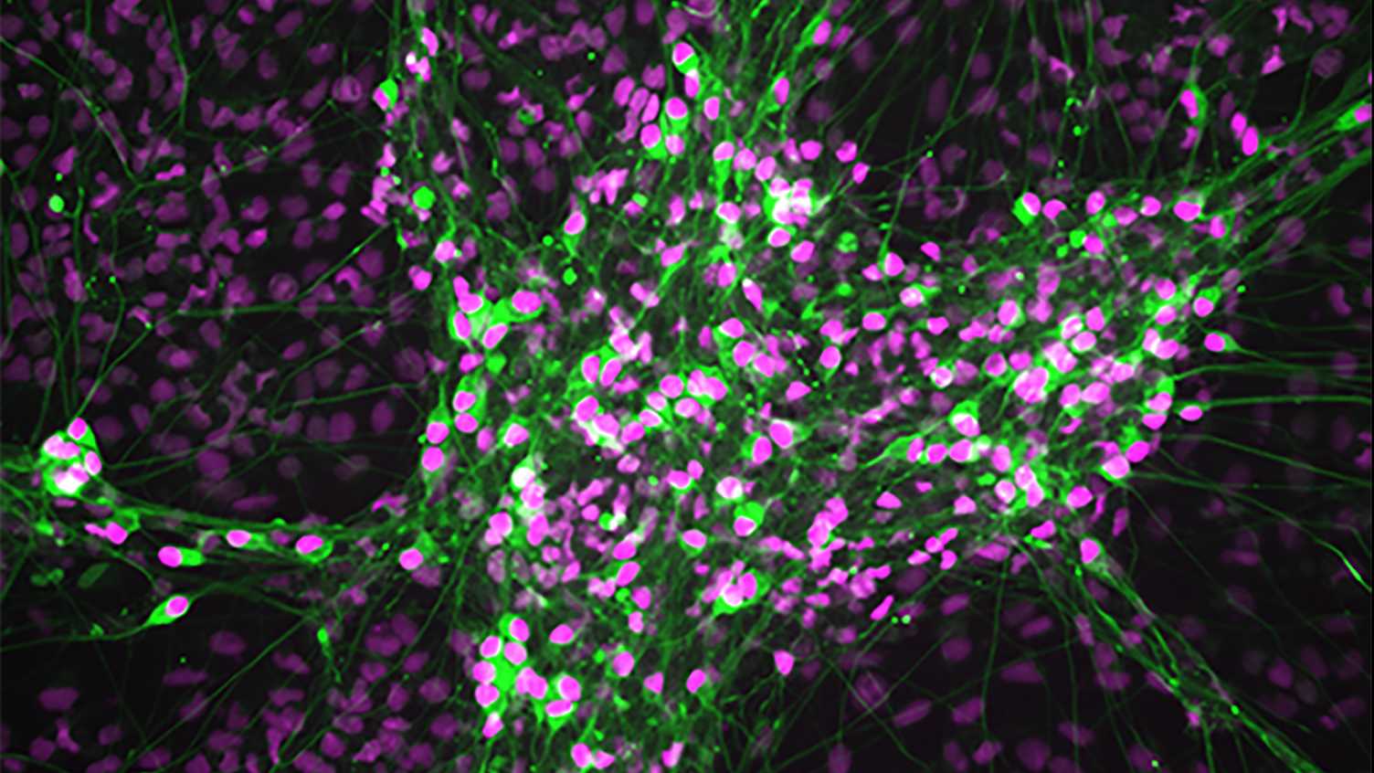 Thumbnail for New study discovers how cells vital for organ function arise during early human …