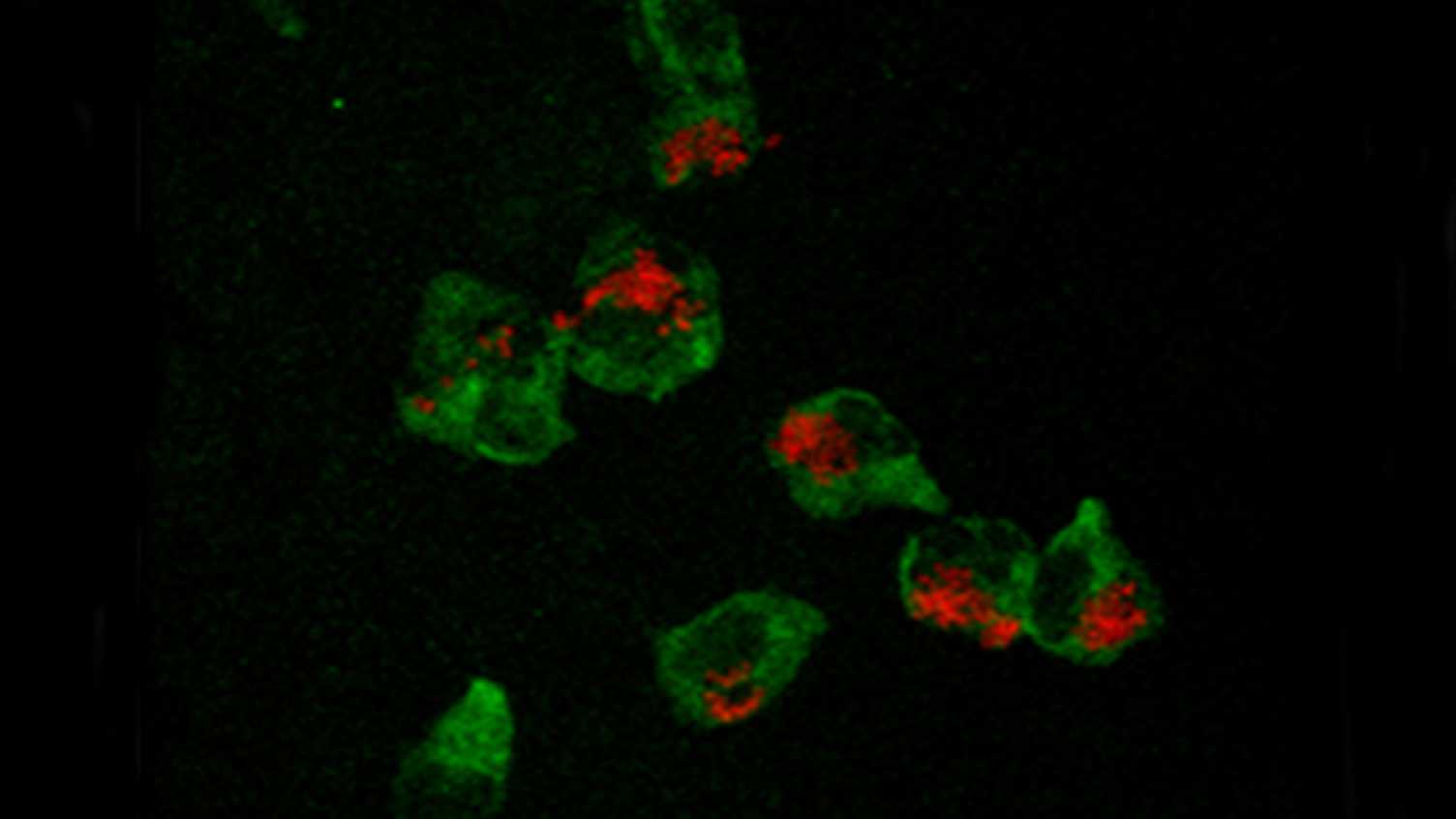 Thumbnail for Scientists discover how superbugs hide from their host | Biosciences 