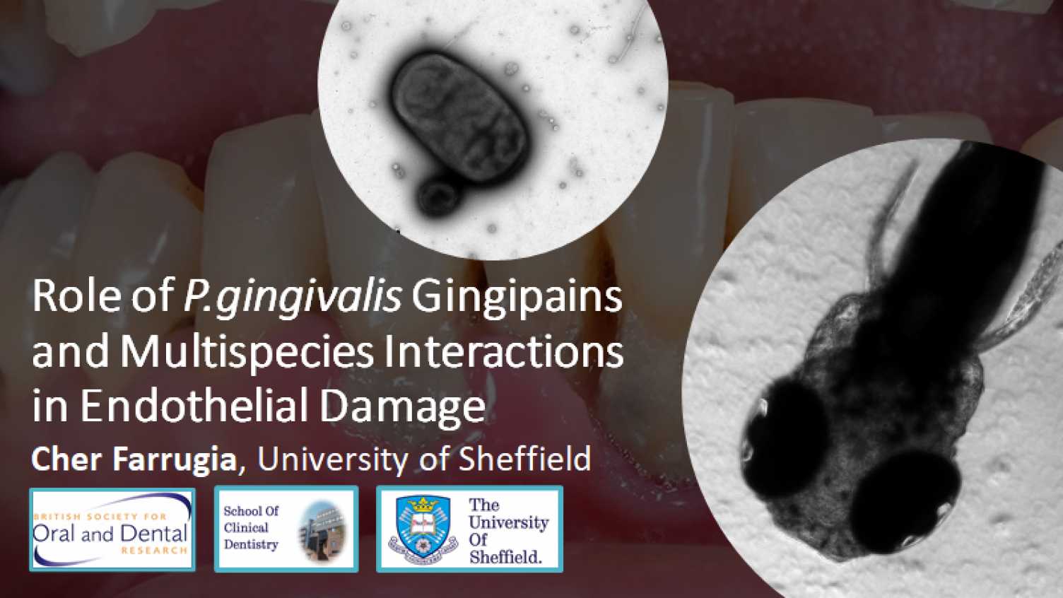 Thumbnail for Dentistry students awarded prestigious prizes for their project efforts | Clinic…