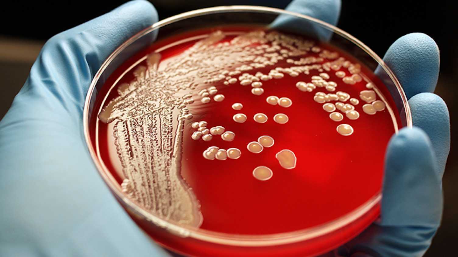 Thumbnail for Genetic mutations help MRSA to become highly resistant to antibiotics | Bioscien…