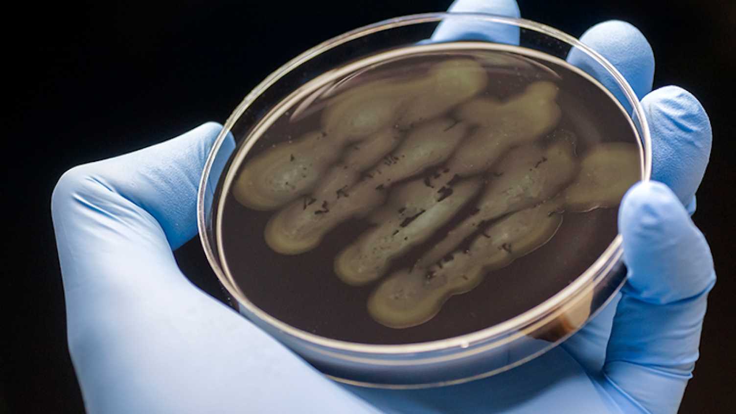 Thumbnail for Intensive farming increases risk of epidemics, warn scientists | Biosciences 