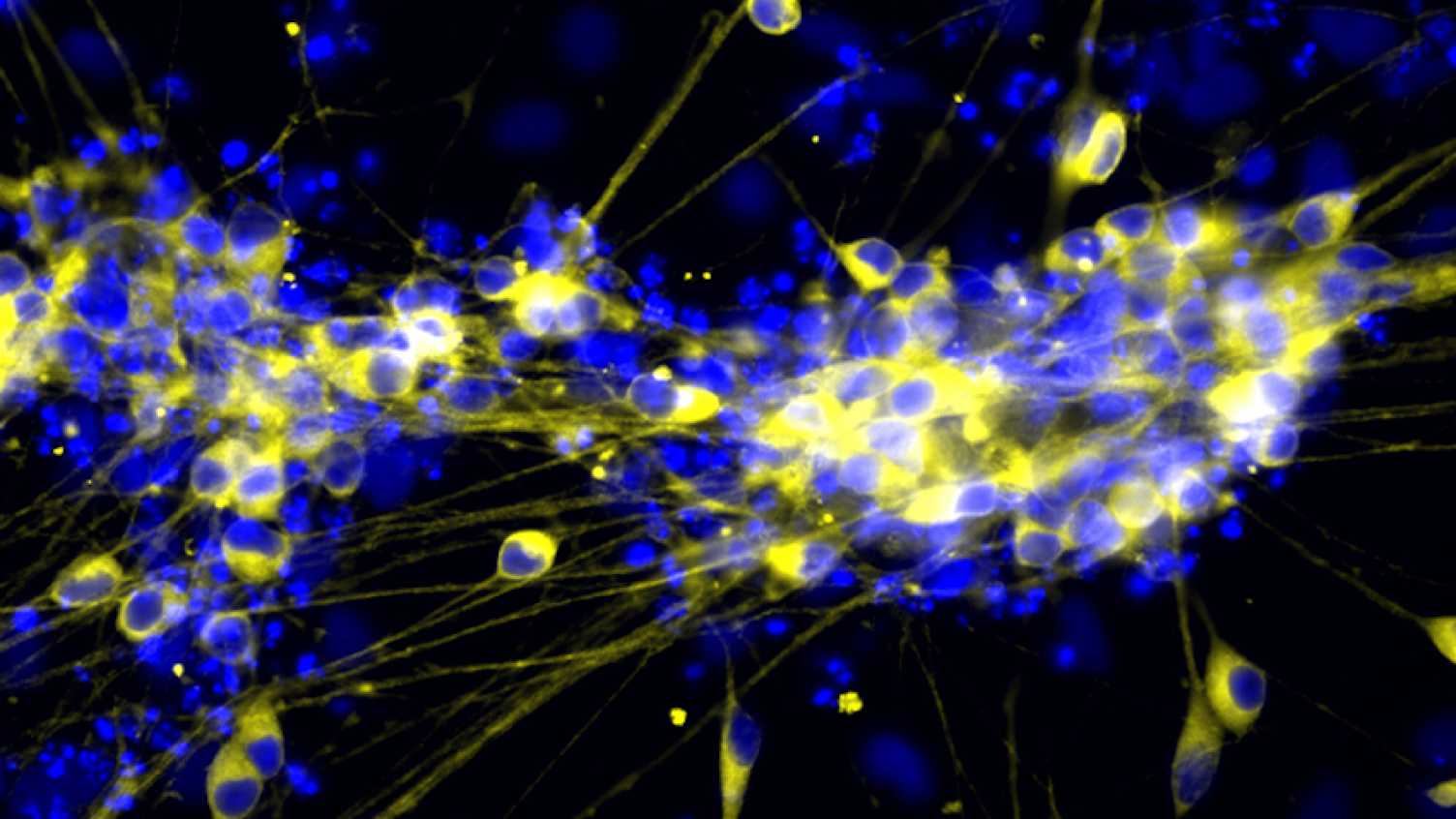 Thumbnail for Scientists make first step towards using stem cells to treat enteric nervous sys…