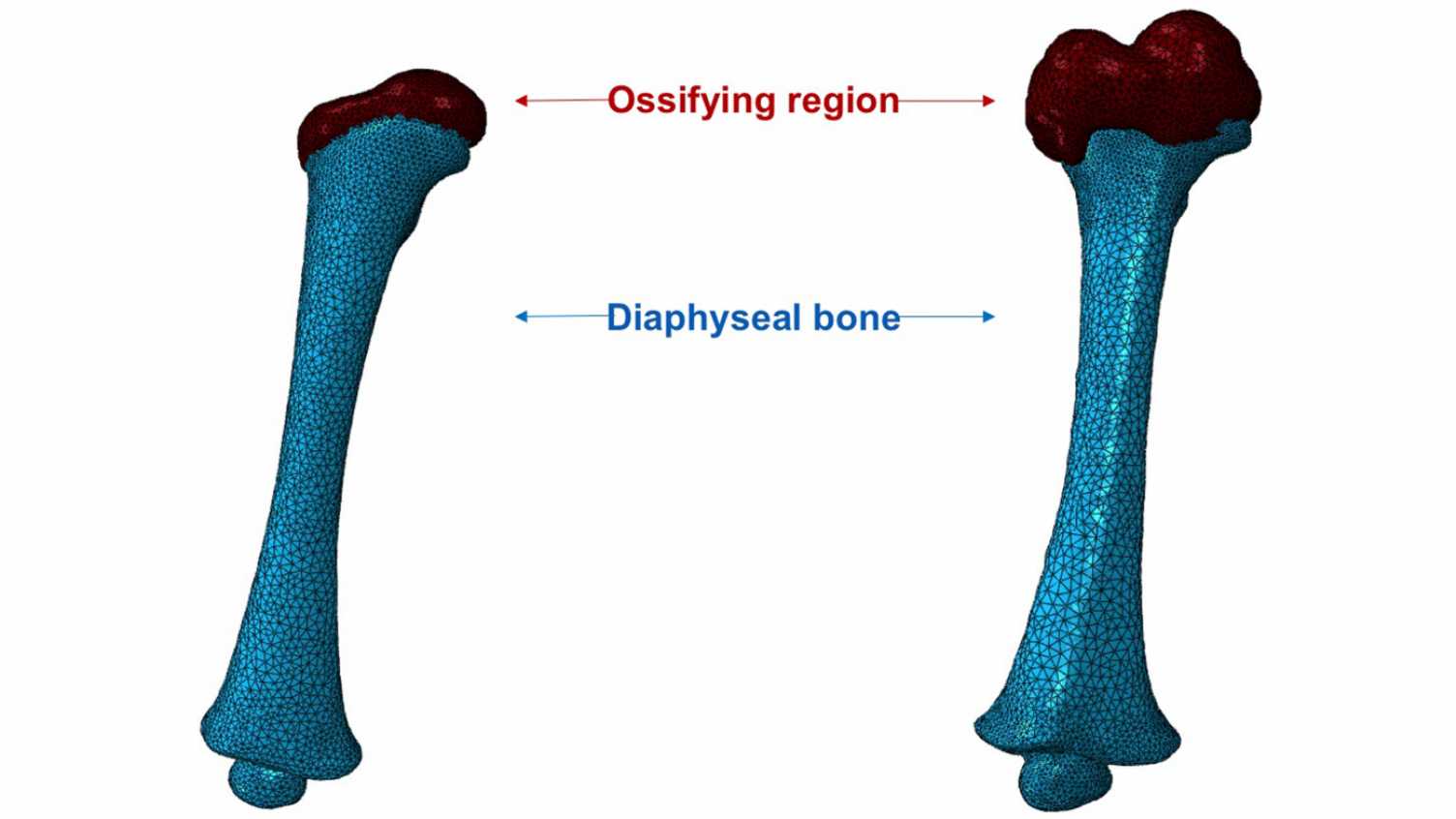 Thumbnail for Finite Element Modelling of the Developing Infant Femur Using Paired CT and MRI …