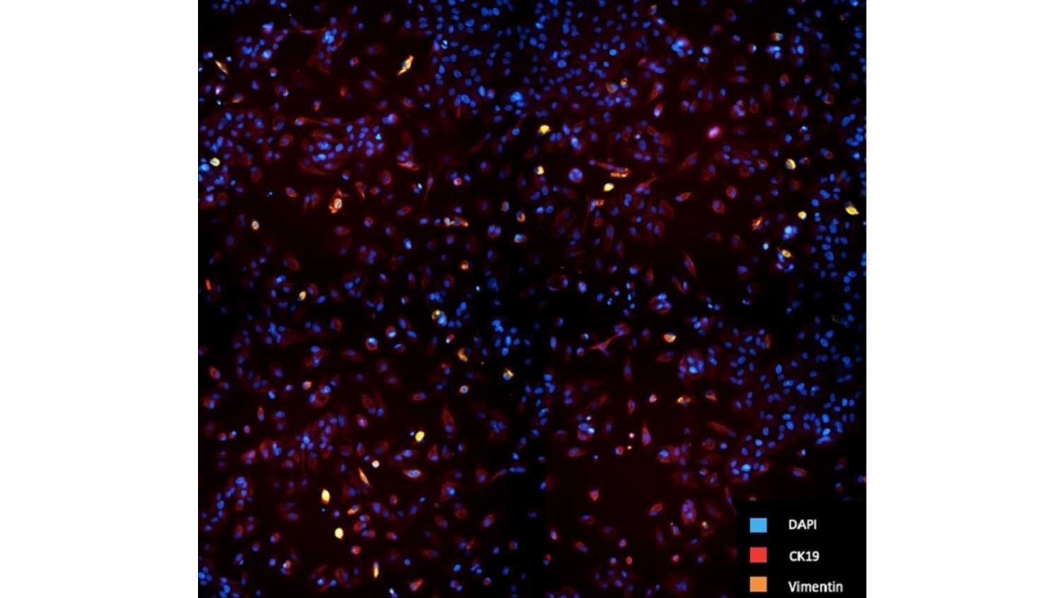 Thumbnail for PhD student conducts research on Ex-vivo high-throughput drug screening in bladd…