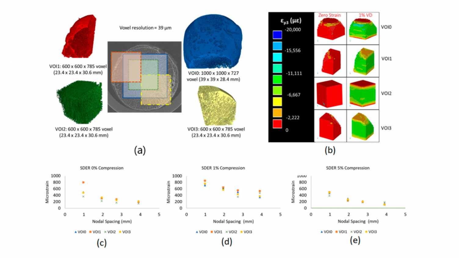 Thumbnail for Heterogeneous strain distribution in the subchondral bone of osteoarthritic femo…