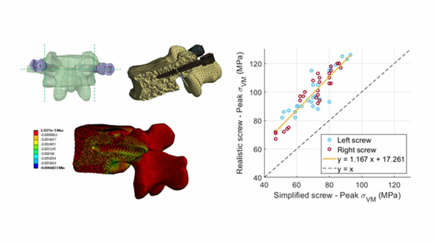 Thumbnail for Patient-specific finite element models of posterior pedicle screw fixation: effe…