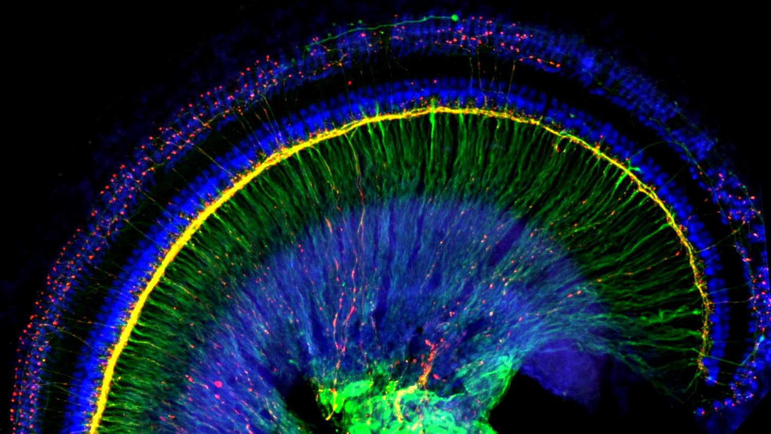 Thumbnail for Hearing Research Group | Hearing and Balance 