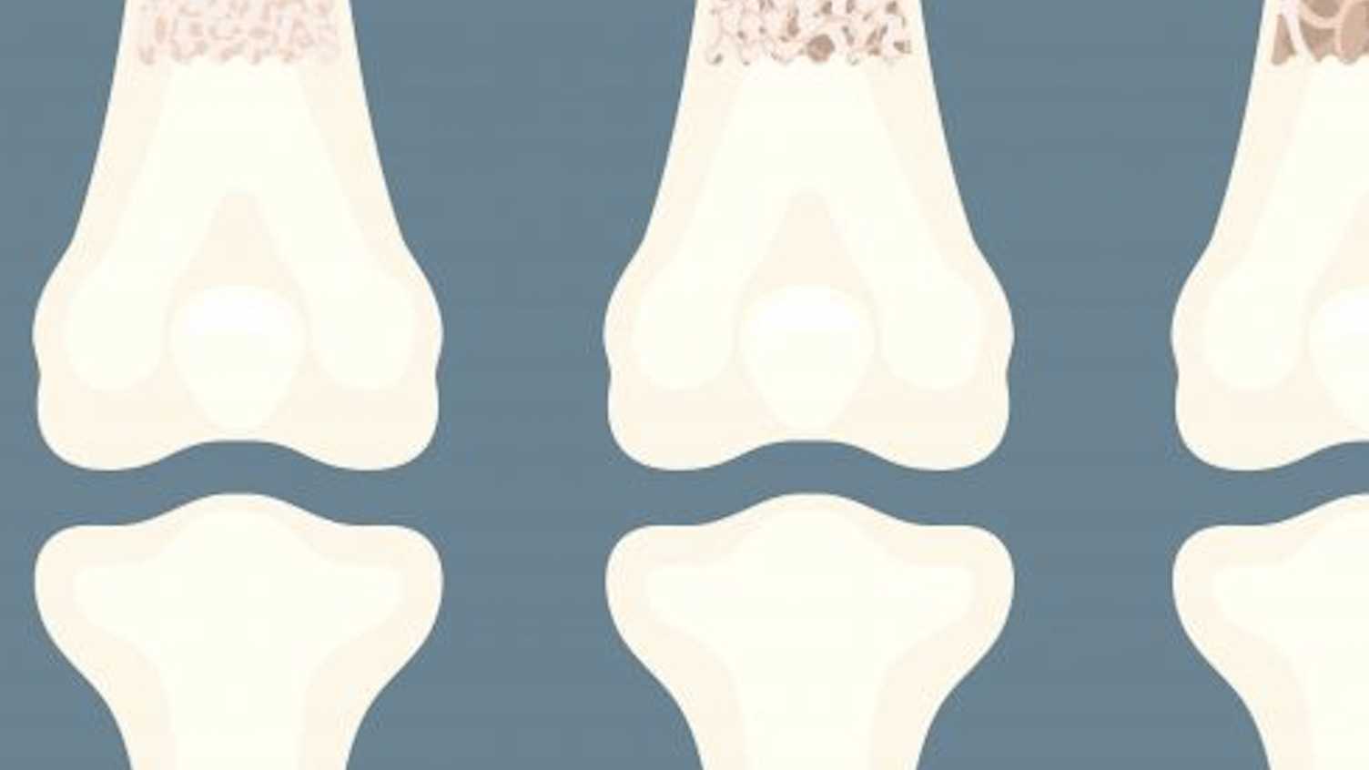 Thumbnail for Mix & Match: Constituting racialised communities in UK stem cell donation | iHum…