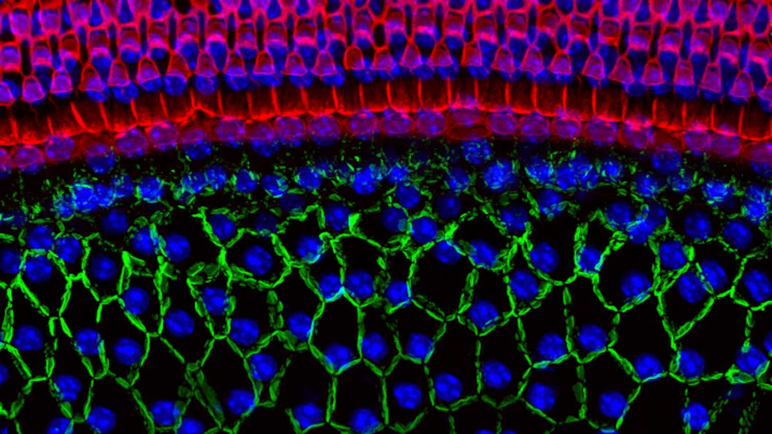 Thumbnail for Groundbreaking research to tackle hearing loss | Biosciences 
