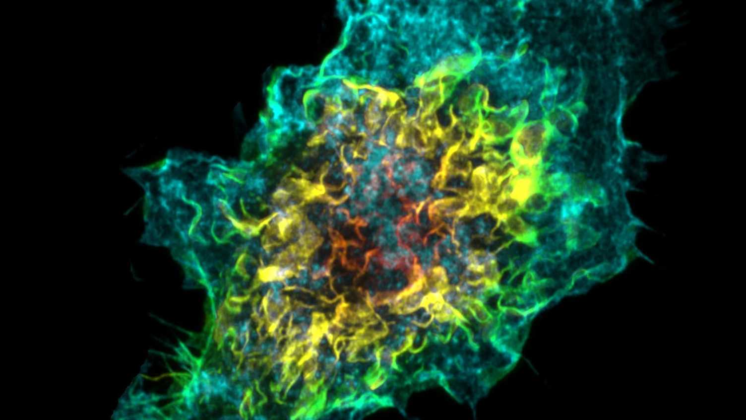 Thumbnail for Florey scientists secure funding to explore a new antifungal therapeutic target …