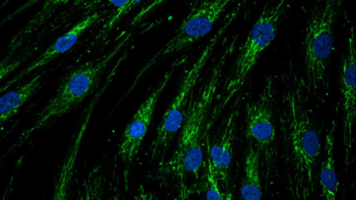Thumbnail for World Alzheimer’s Month - Understanding the mitochondria | Neuroscience Instit…