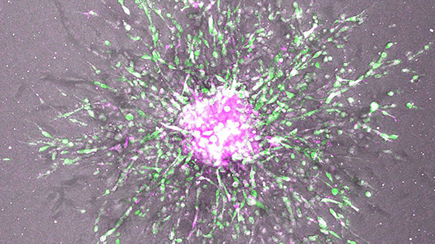 Thumbnail for Scientists identify key protein driving ovarian cancer spread | Biosciences 