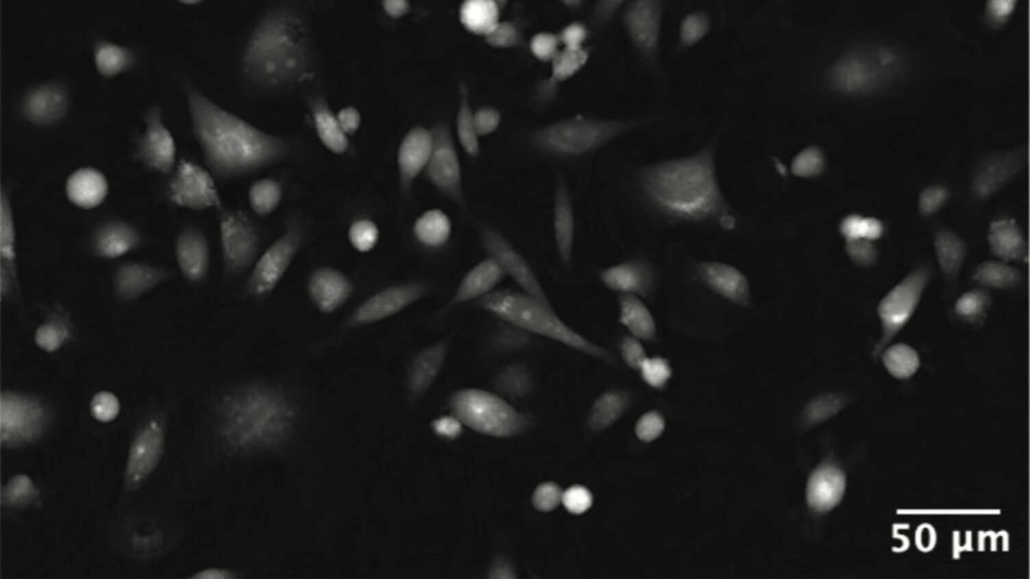 Thumbnail for Removing barriers to advanced imaging and machine learning-based analysis | CMBE…