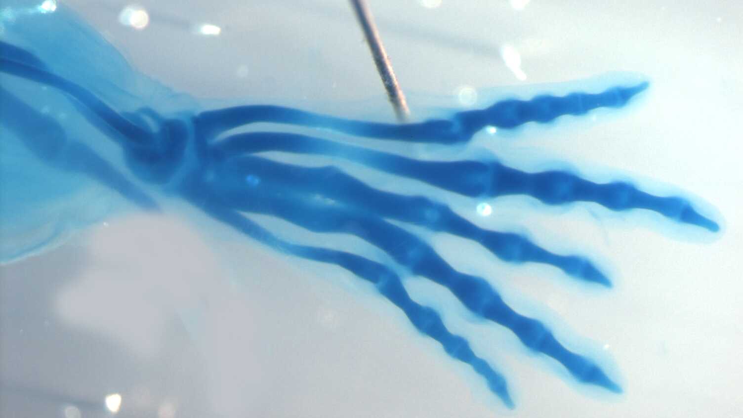 Thumbnail for Limb formation research could offer new insights into birth defects and regenera…